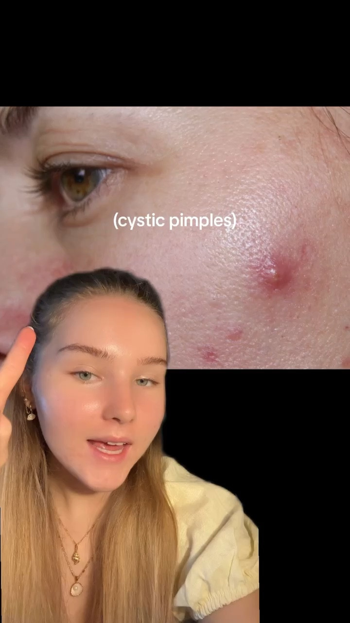 if your skin looks like this, use this!