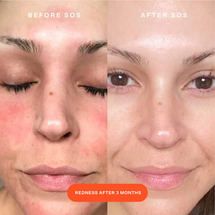 SOS Daily Rescue Facial Spray with Hypochlorous Acid | Sephora (US)