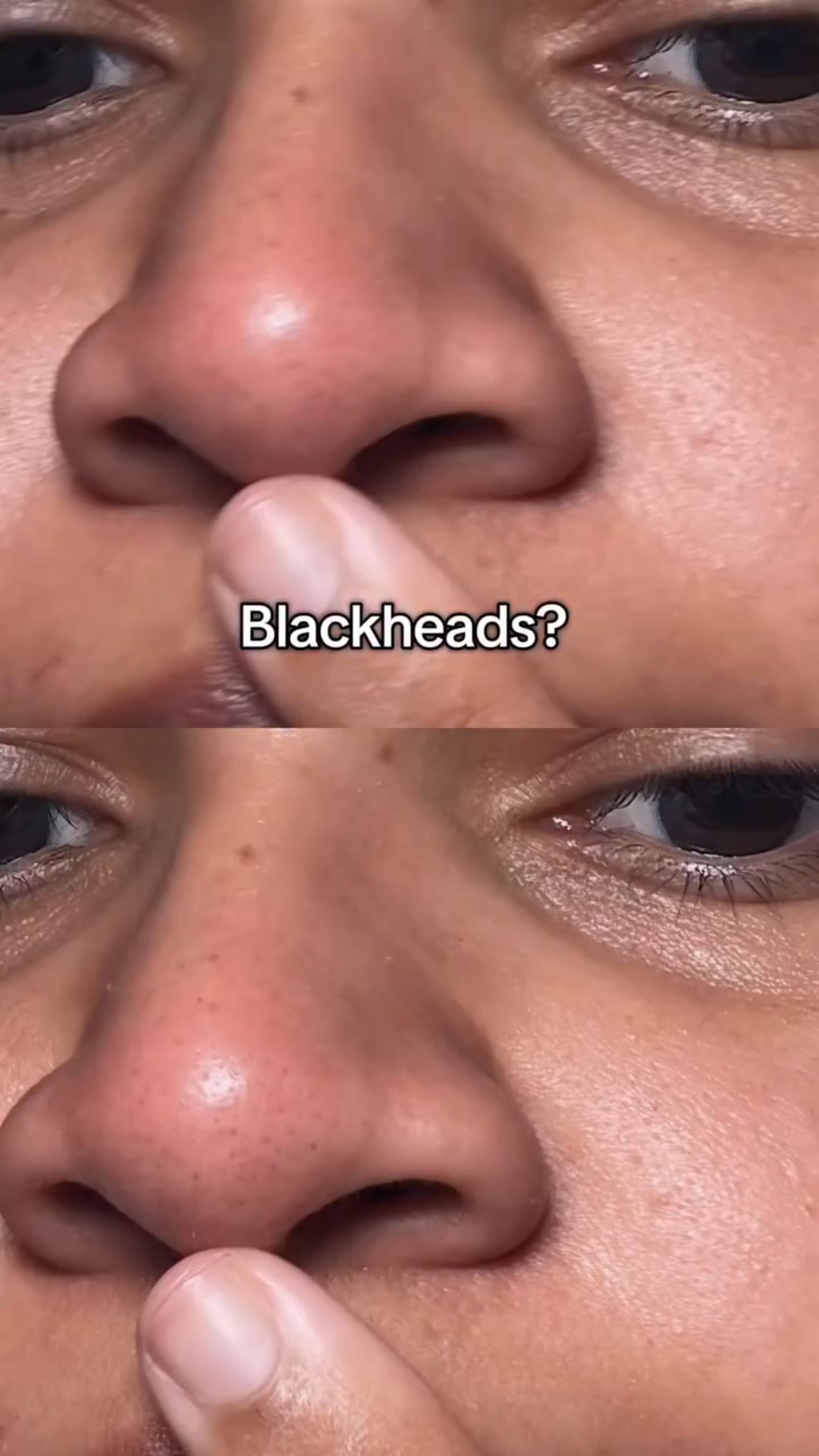 As someone with combination skin with an extremely oily T zone, l’m always skeptical about trying new cleansing oil/ oil cleanser.With skin care ingredients such as PHA, jojoba oil, grape seed oil and tea tree oil @hanskin_global pore cleansing oil remove makeup, impurities and blackheads with one step without stripping your skin.  @hwahae_official @hwahae_global_official  #Hwahae #hanskin #porecleansingoil
#skincare #kbeauty #koreanskincare #oilcleanser #fyp #reels #skincare #skncarereels #trending #nyccontentcreator #blackheads #oilcleanser