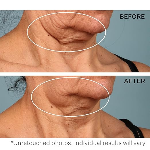 StriVectin Tighten & Lift Advanced Neck Cream PLUS with Alpha-3 Peptides™ for Neck & Décollet... | Amazon (US)