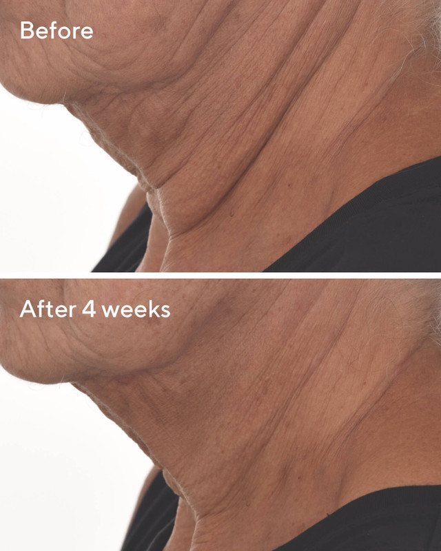 Retinal ReSculpt Overnight Treatment | Murad Skin Care (US)