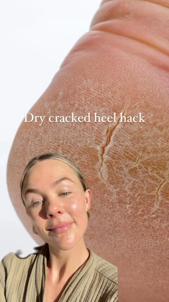 Best nontoxic 1-step foot mask to soften, hydrate, and moisturize your heels! 

#LTKVideo #LTKU #LTKBeauty