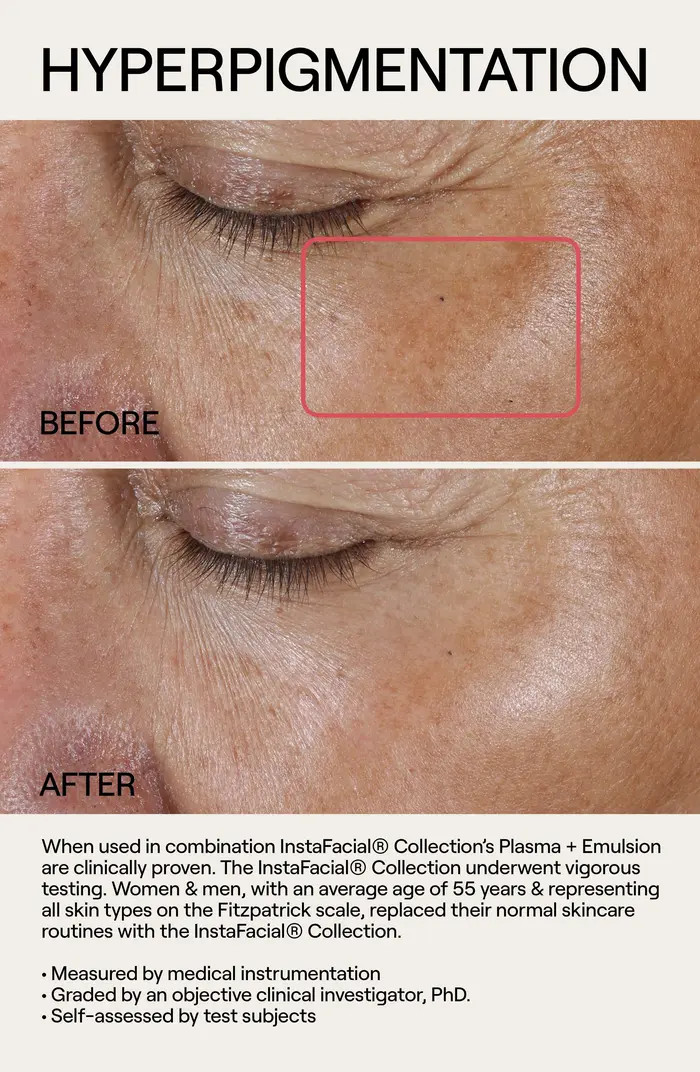 Instafacial® Plasma Serum Duo $400 Value | Nordstrom