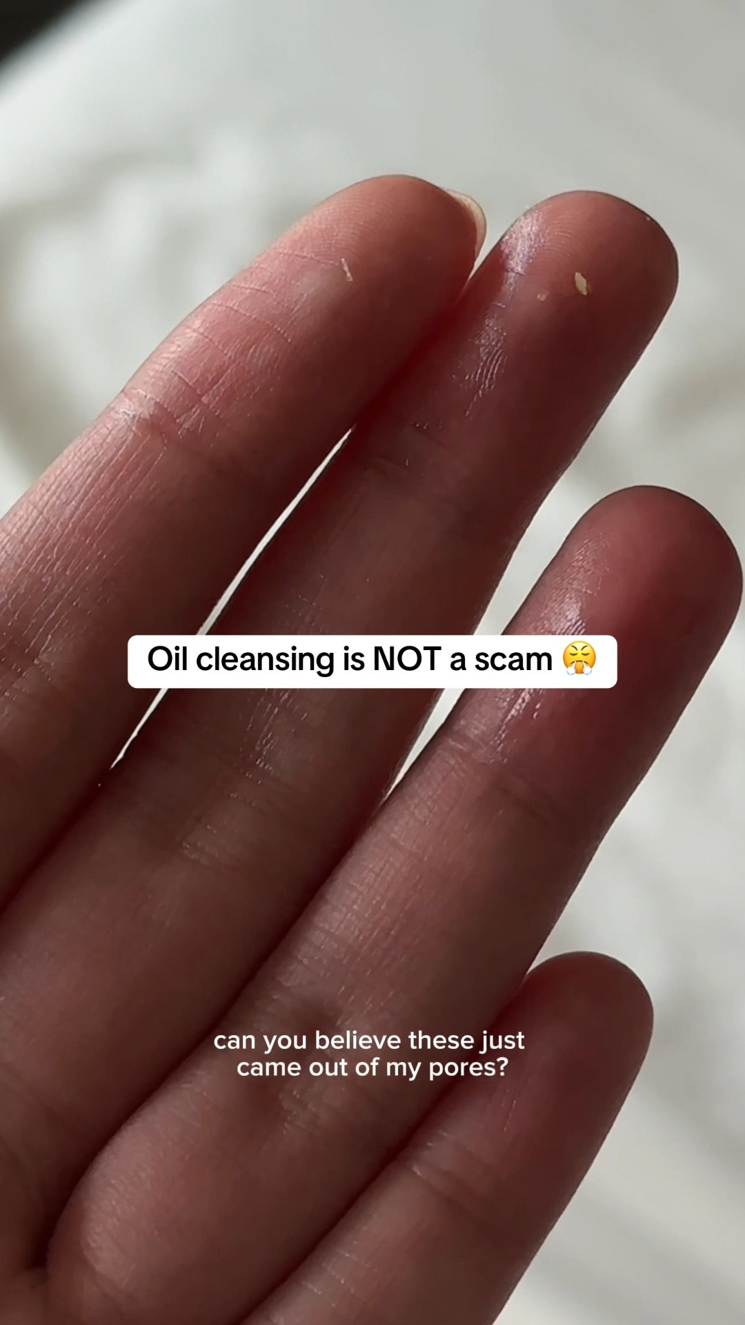 this cleansing duo from @haruharu_wonder is SO underrated! Both are also *unscented* so they’re perfect for acne prone and sensitive skin 🫰🏼 it’s available on Amazon, added to my sf 🫶🏼 #haruharuwonder #vegan #koreanskincare #doublecleansing #acneproneskin #sensitiveskin #cleansingoil #ad


#LTKVideo #LTKFindsUnder50 #LTKBeauty