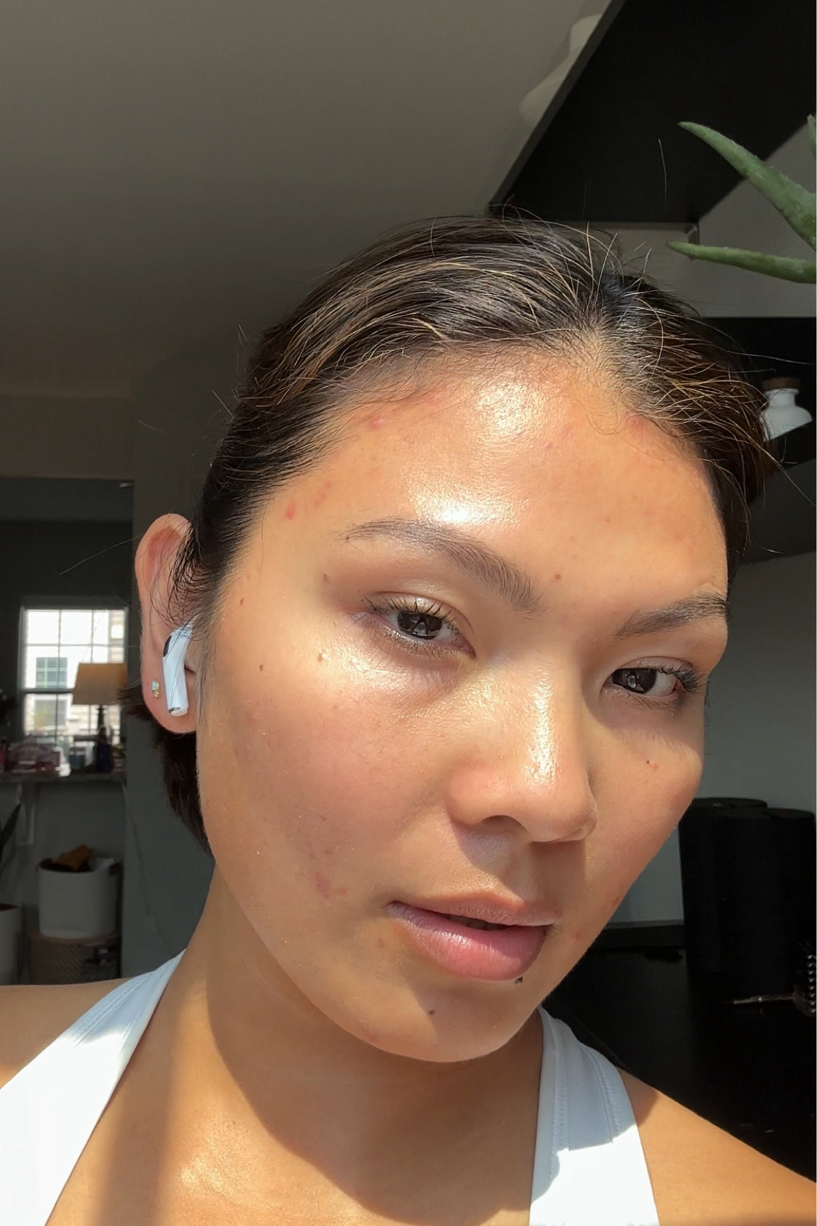 Acne routine