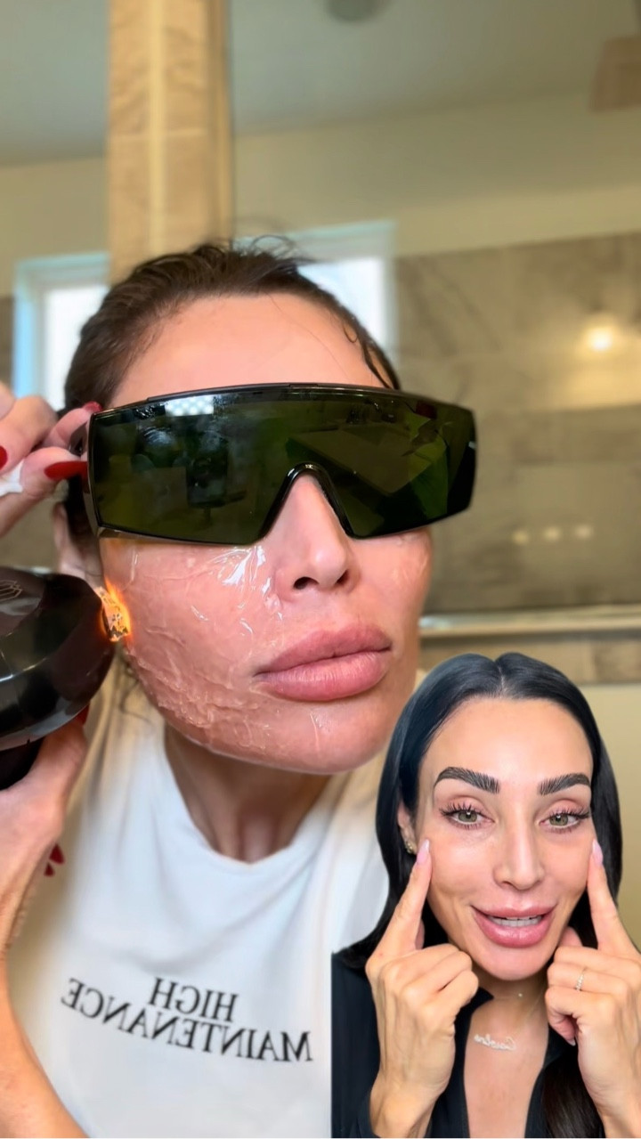 Protect your investment and give your skin what it actually needs. Here’s what I focus on post treatment.
✔️ Lay off actives and retinols
✔️ No exfoliating 
✔️ Do not pick or peel shedding skin
✔️ Stay out of direct sun and wear SPF
✔️ Avoid excess heat, sweating, saunas or jacuzzis depending on the treatment
✔️ Prioritize barrier repair and hydration
Once you’re past that initial 24 hour window and your skin is starting to calm, that’s when I introduce something like epii_global Double Up Cream to help hydrate, support and protect while healing.

Comment POSTCARE if you want the link! 

#skincaretips #epii  #medicalaesthetics #skincare101 #doubleupcream