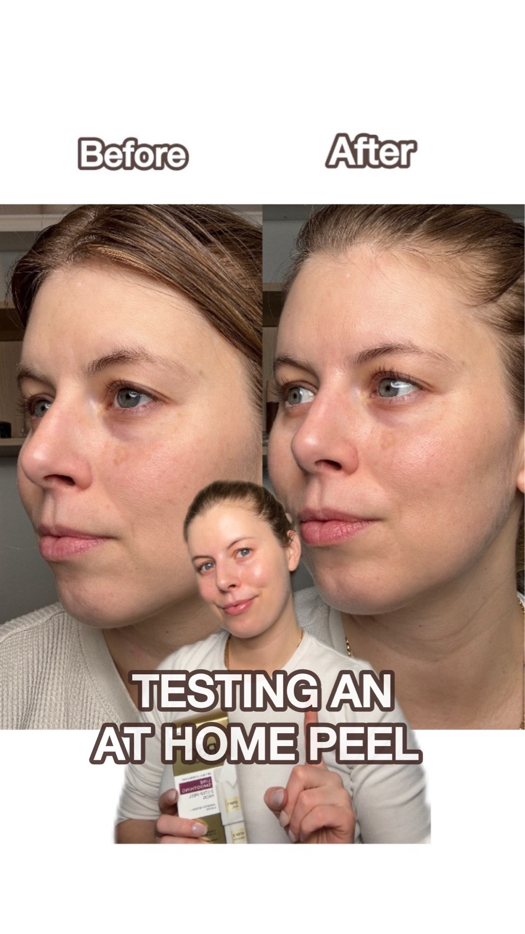 #ad Using these truly brought my skin back to life…and saved me so much time and money!! 

You can get these @rocskincare Line Smoothing 2 Step Peel Pads at Target or through my LTK shop

@rocskincare @target @shop.ltk #roc_partner #rocskincare #skintok #targetpartner #target

#LTKBeauty