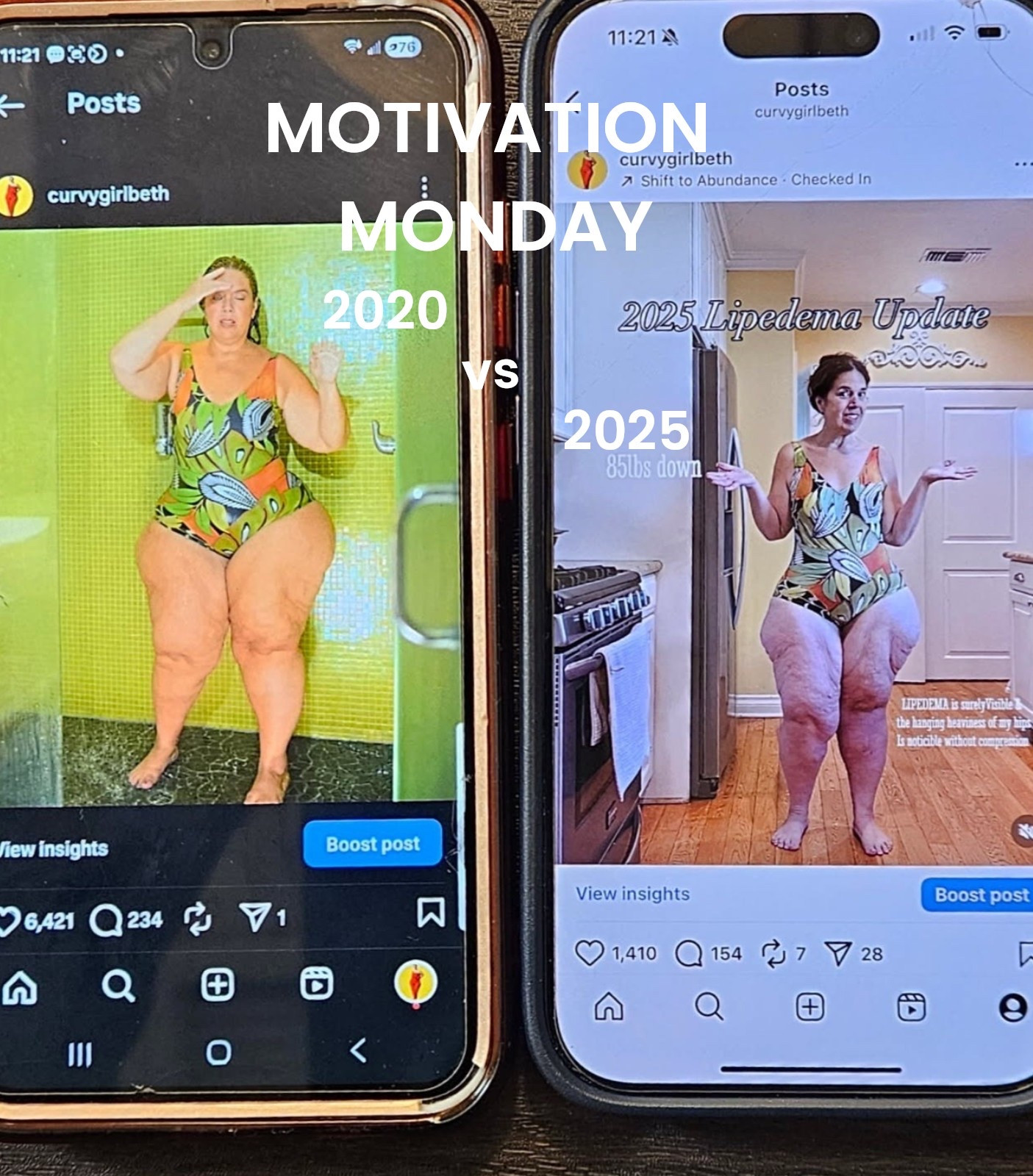 LADIES! Yeah, I’m talking to you🩷

Change IS possible!

Never give up 🙏

Sometimes Massive Action is required to create a new trajectory👏
You can do hard things! 

Comment COMMUNITY to navigate  your new chapter together!
#womenscommunity #lipedema
#glp1! #weightlosscommunity #bariatricbabes

#LTKOver40 #LTKPlusSize #LTKMidsize