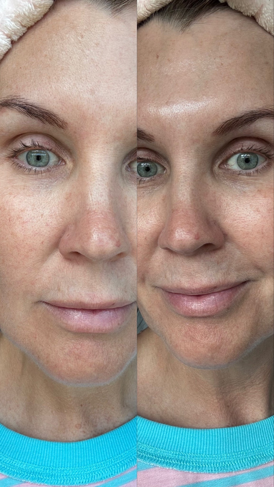 This gives ultimate hydration to my 47yr old skin! 


A lightweight, glycerin-rich jelly moisturizer that sinks in quickly to hydrate and deliver a concentrated complex of plant-based PDRN (ultra-refined DNA fragments from plants, developed for efficient absorption and renewal). Niacinamide, Sodium Hyaluronate, and Matrixyl® 3000 peptides—refining texture, targeting the look of fine lines, evening the appearance of tone, and helping strengthen the skin’s moisture barrier. The bouncy jelly glides on and absorbs effortlessly, leaving skin smooth, balanced, and hydrated.

Naturally pink from Vitamin B12; color may vary or fade over time—potency remains intact, and it always applies clear.

Mix it with our Hydrating Overnight Mask with Peptides to create the ultimate nighttime moisture boost.