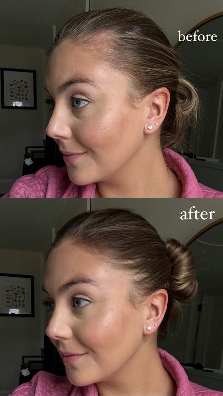 Before & After using Root Boost spray to fill in when wearing my hair in a pony tail! On sale now for 17% off and under $10. 

#LTKbeauty #LTKsalealert #LTKstyletip
