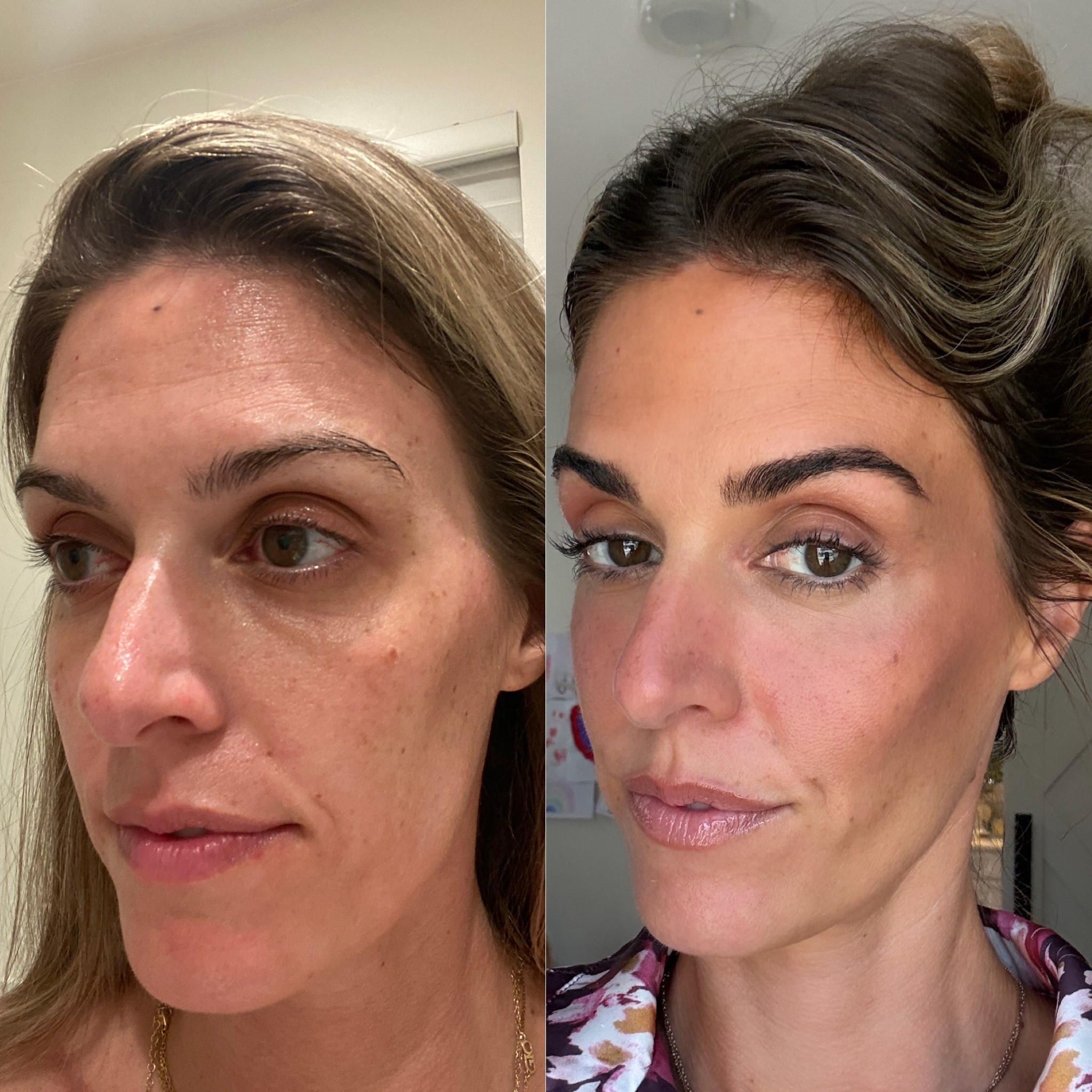 I’m always amazed when I look back at my lashes and brows before I started using the Babe Original serums! I have no mascara on in either photo and just a little clear eyebrow gel on the right. My brows are so much more full now and my lashes are thicker and longer 👌🏻 Really helps on those days I go little to no makeup! 

Babe Original, eyebrow serum, eyelash serum, everyday makeup, natural makeup, summer daytime makeup, glowy makeup, beauty routine

#LTKBeauty #LTKselfcare #LTKgrwm
