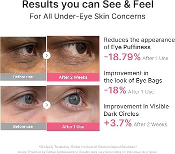 PDRN Retinol & Collagen Gel Mask - Eye Patches for the appearance of Dark Circles, Undereye Bags ... | Amazon (US)