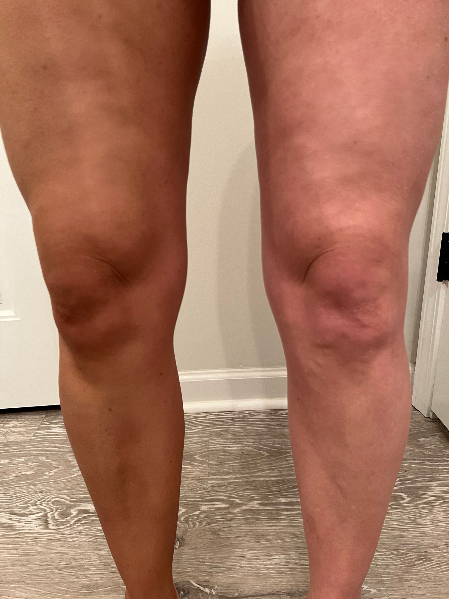 Please ignore my legs… and the lighting was a little funky in my bathroom from the blinds, but I HAD to show you just how quick and amazing this self tanner is. This was immediately after applying it to one leg. I’ve experimented with sooo many over the years, and this is by far my favorite! 

I’m also posting the face tanner that I’m currently using and absolutely love! 

#LTKunder50 #LTKFind #LTKbeauty