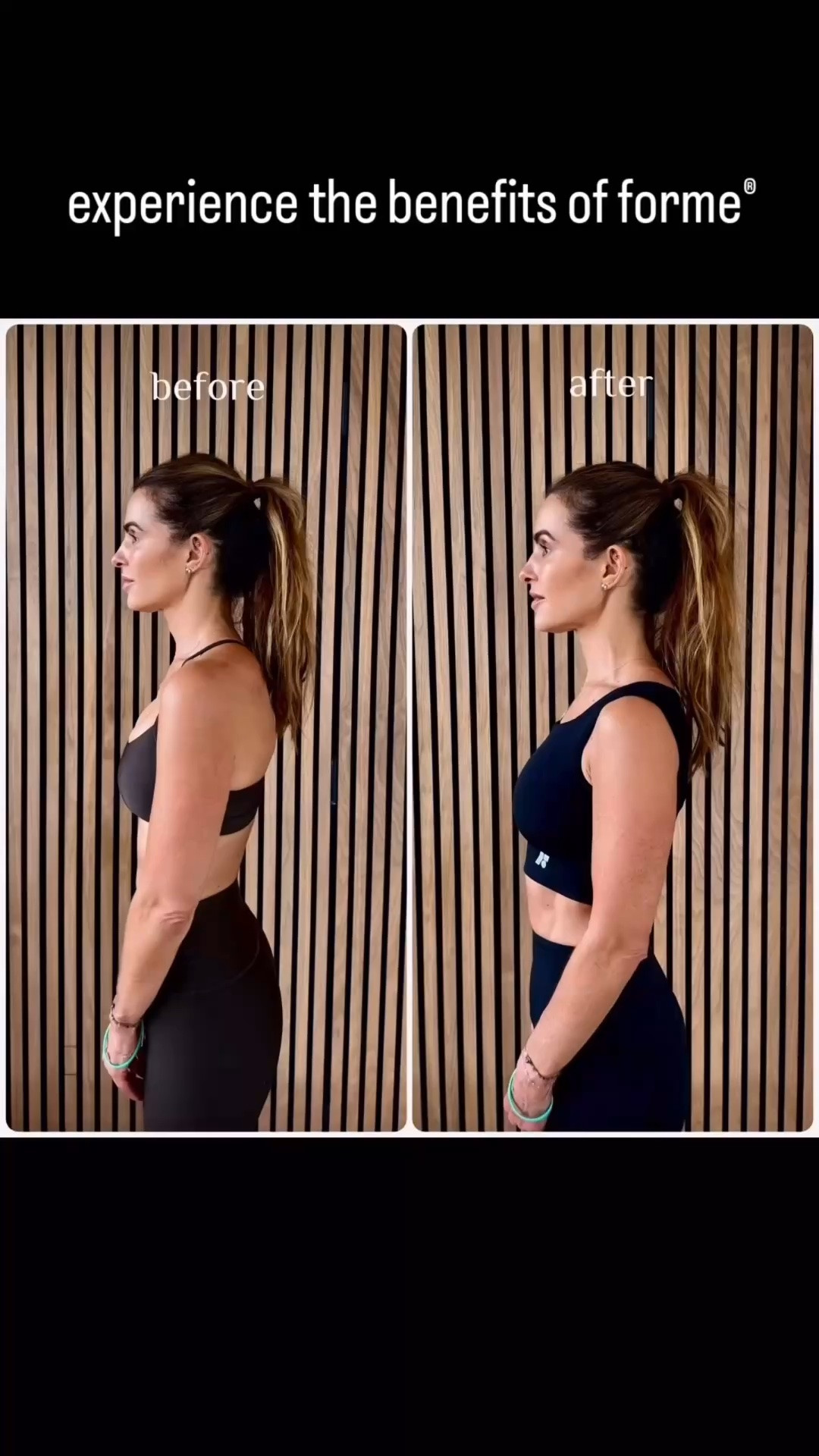 Can what you wear actually help transform your posture and how your body feels every day?

The Short answer: yes! 

@forme.science engineers smart clothing for your best posture, recovery, and back health. 

When I started wearing it consistently, I noticed it gently guiding me into better alignment throughout the day. 

My shoulders stopped rounding forward as much & my back felt more supported.

I could feel the improvement—less tension, better posture awareness, and more openness through my chest and shoulders.

The coolest part? You can take the quick Posture Score Quiz: https://forme.science/pages/posture-score 

and see where you’re starting from, and how Forme® can help you:
*Stand Taller
*Breathe Better
*Support your back health and recovery 

I’ve seen how much it’s improved my posture and body awareness. 

Your turn to see what your score says and where you can go from here!

ON SALE RN:
+ $50 off orders $250+ of men’s or unisex wearables
with code FATHERSDAY50

Buy 2 Forme® Socks, Get 1 Free Arch Booster Sock

Unlock Free US Shipping with orders of 3+ pairs
of Forme® Socks or $250+
 
#formescience #forme #formesciencepartner 


@forme

#LTKfitnessgoals #LTKselfcare #LTKActive