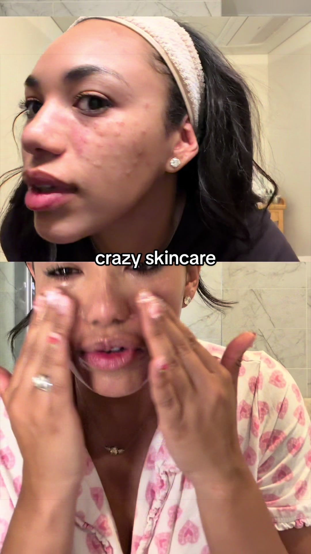 I didn’t sleep in my makeup !!go me #skincare #nightime #nightskincareroutine @Rael @Caudalie @Summer Fridays

#LTKgrwm #LTKselfcare #LTKBeauty