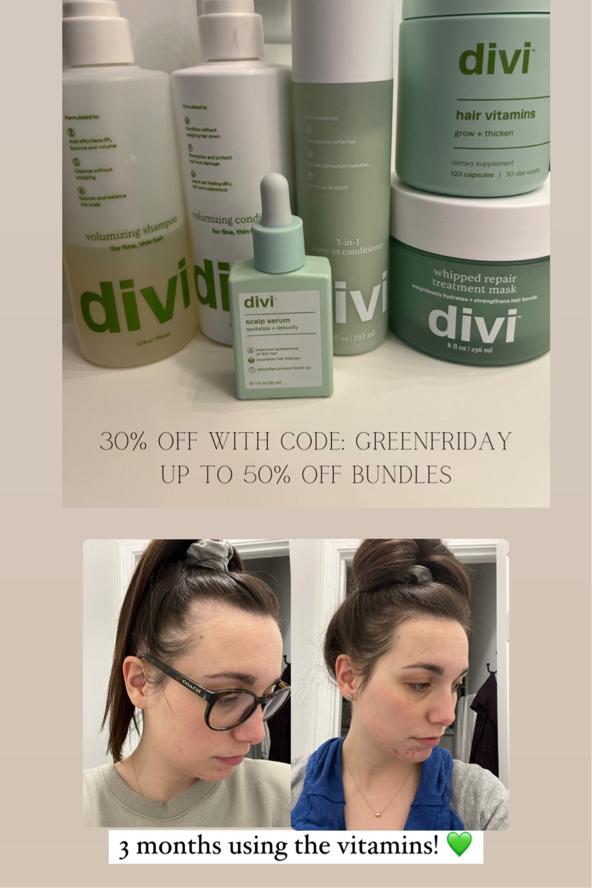 I’ve been using the Divi hair serum since it released! Now, I use all the Divi products. I have the dry shampoo too, but I forgot to grab it for this pic! I switch between Divi & Living Proof. I love both! Divi is cleaner though! 💚 The divi vitamins have really been helping with my postpartum hair loss! This is after 3 months of use! 🙌🏻

#LTKBeauty #LTKBaby #LTKSaleAlert