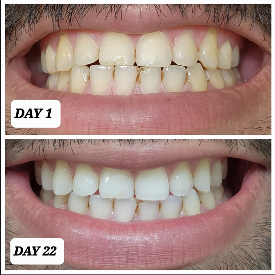 Just look at those results! And they’re on sale!

#LTKSaleAlert