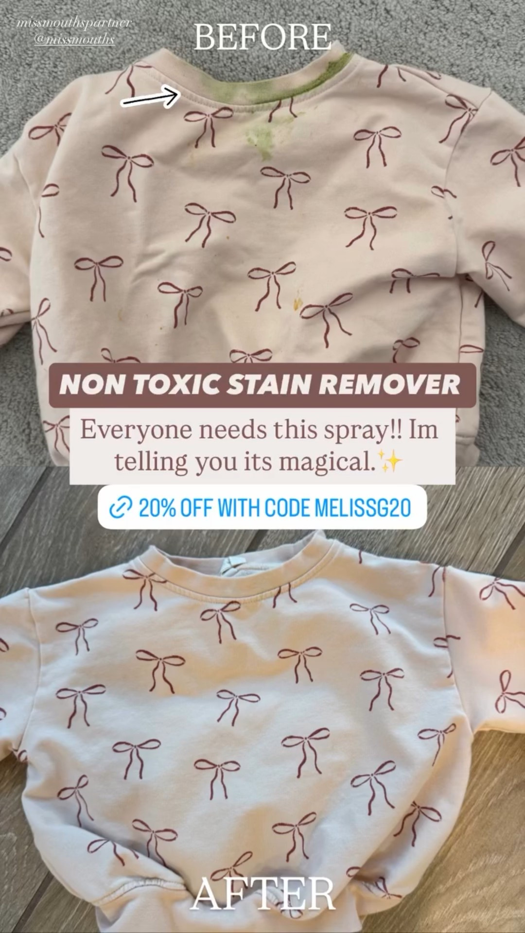 Everyone needs this spray!! Im telling you its magical.✨ BEFORE AFTER missmouthspartner @missmouths  NON TOXIC STAIN REMOVER  Shinkansen