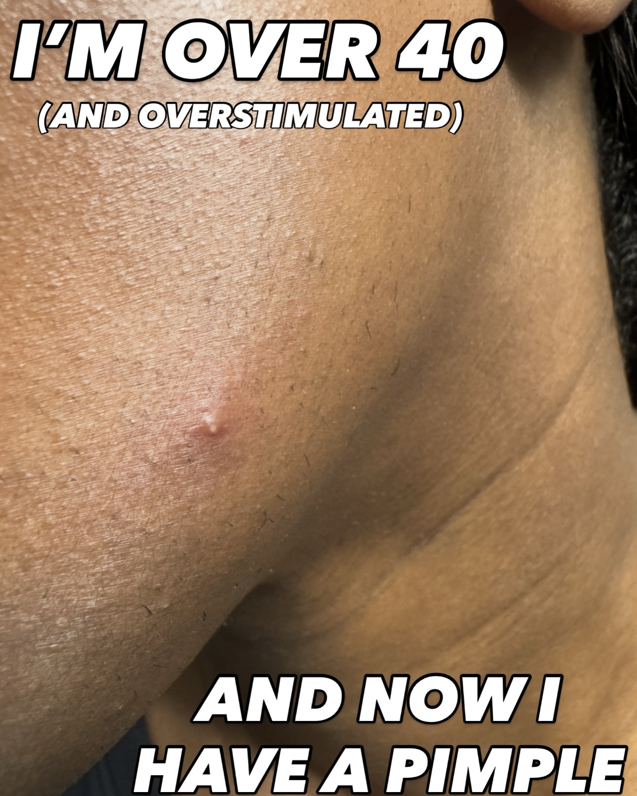 My fave products for occasional acne 

#LTKOver40 #LTKFindsUnder50 #LTKBeauty