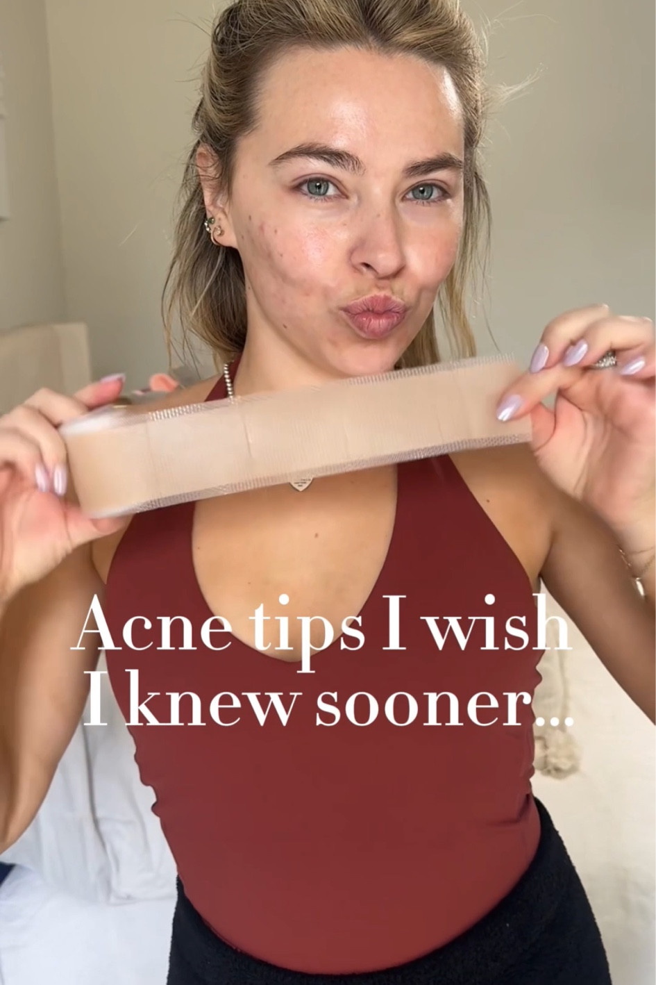 Acne tips I wish I knew sooner…
	1.	Scar tape – so underrated. Pop it on before bed and wake up with smoother skin + less scarring.
	2.	Beef tallow – literally saved me from going on Accutane. All-natural, non-comedogenic, and packed with skin-loving vitamins = glow city.
	3.	This pot concealer – full coverage that actually lasts. Liquid could never.

Just a few of my holy grails for healing and confidence.


#LTKStyleTip #LTKBeauty #LTKSaleAlert