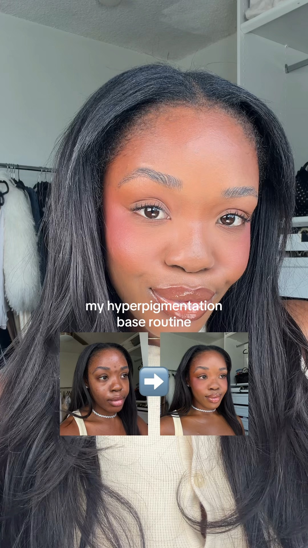 this makeup routine never fails me 🤏🏾✨how I cover my dark spots and get a flawless base without putting on 10lbs of makeup 🍰
#hyperpigmentationhottie #hyperpigmentation #acnemakeup #darkspots #makeuptransformations

#LTKBeauty