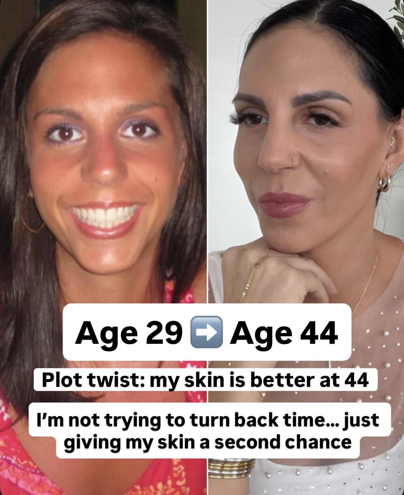 The products I use and swear by- this glow up is the real deal. It’s all consistency, doing the right things and it can happen at any age 
Sunscreen, Retinol, double cleansing, hydration, and more 

Not linkable is my micro needling, facials, and Botox I get regularly. 

#LTKOver40 #LTKU #LTKselfcare