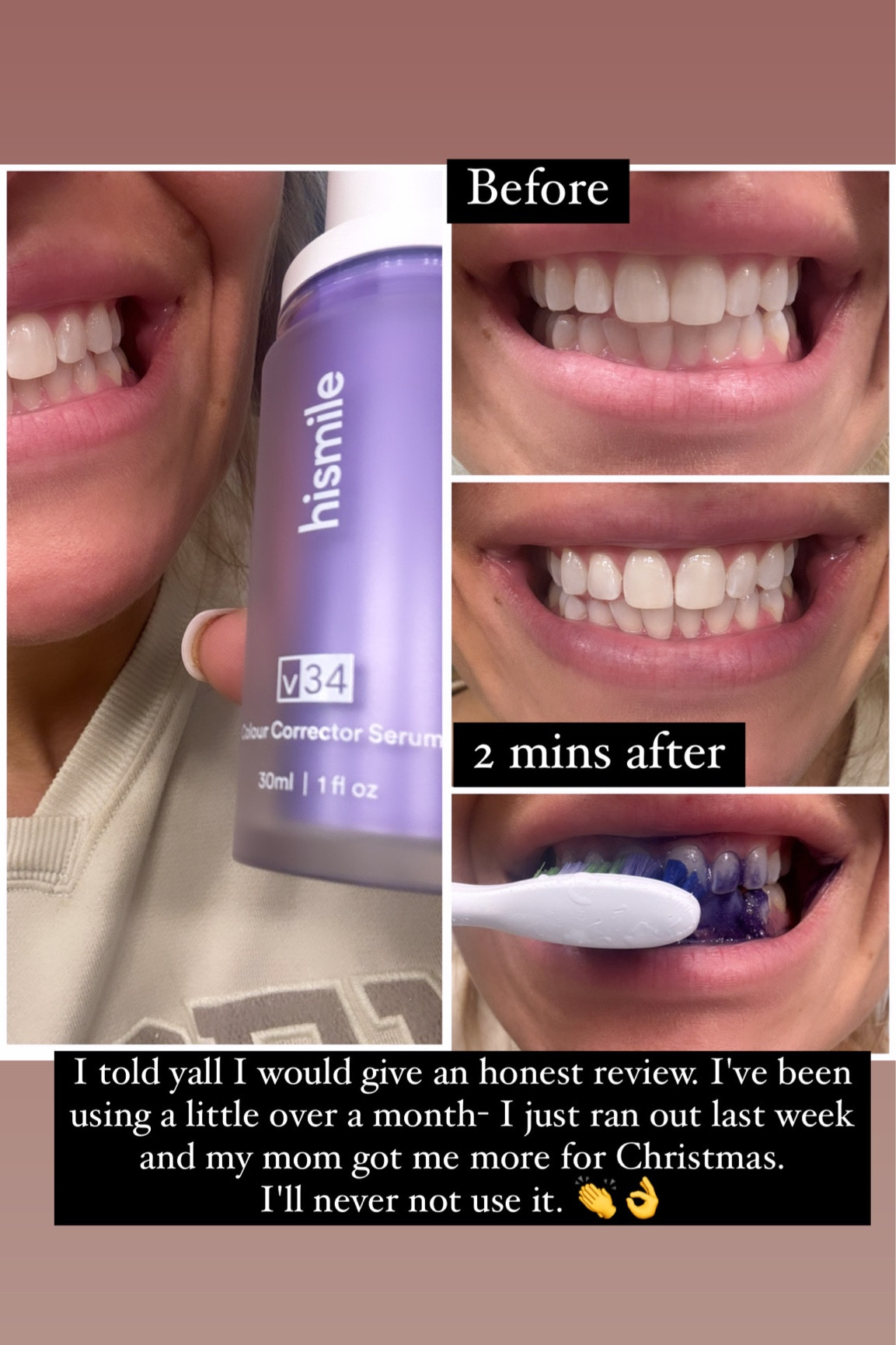 Teeth whitening color corrector #ltkbeauty #wellness #beauty

#LTKGiftGuide