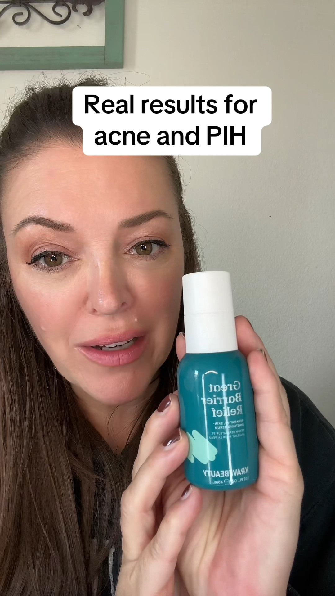 This clears acne and PIH too!!!!

#LTKFindsUnder50 #LTKBeauty