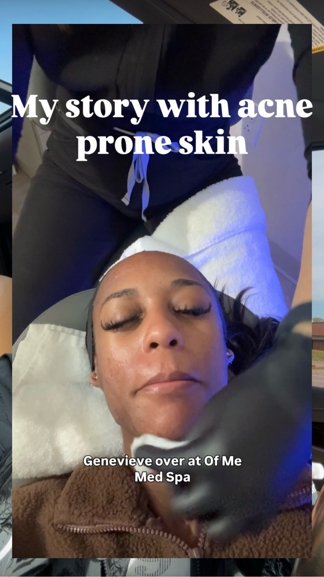 After battling acne for 10 years, I’ve finally been able to maintain it, figuring out what my skin needed and responded well with took years of trial and error and money. So I’m sharing my favorite products that I use on a weekly basis to maintain a healthy acne free glow 🤍


#LTKBeauty #LTKgrwm #LTKdayinmylife