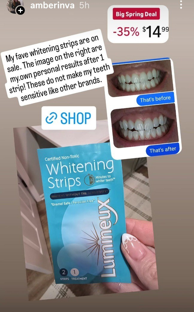 My fave teeth whitening strips are on sale! These whitening strips are non toxic and perfect for sensitive teeth. #amazonsale #springsale #teethwhitening #cosmeticwhitening #beauty

#LTKOver40 #LTKSaleAlert #LTKBeauty