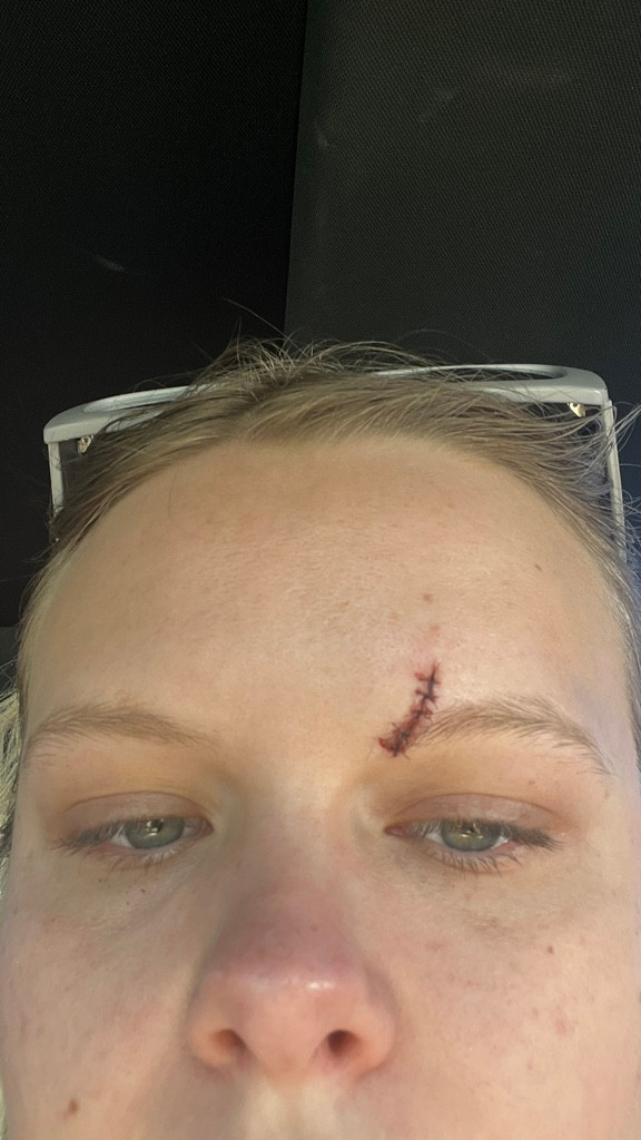 How to cover a SCAR 😳😷🩺

#LTKBeauty #LTKgrwm #LTKstorytime