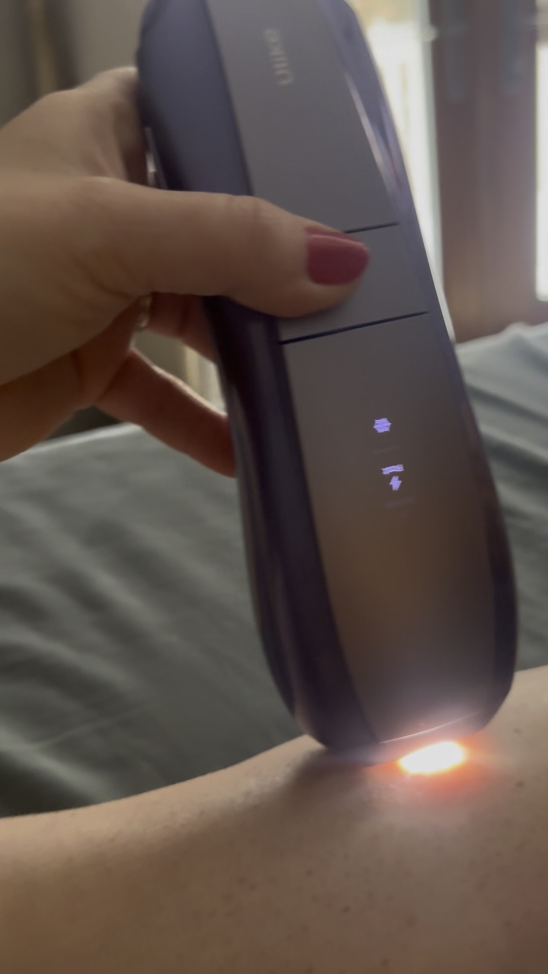 This at home IPL hair remover device is so user friendly. Built in cooling mode to keep your skin soothed and happy during the treatment session. 

As you can see there is a little light that will come in when the device is flush against the skin and will not work until the device is properly situated. The price might seem a bit much st first, but see how much a single session of IPL is in your area now multiply that by 2-3 times a week that it's recommended you do this. It took me minutes to do it at home🥰

No pain. Easy to use. All at home. 

Yes please! 

This is the Ulike Air 10 but I have linked of versions of the device as well! 

#LTKStyleTip #LTKBeauty #LTKWatchNow