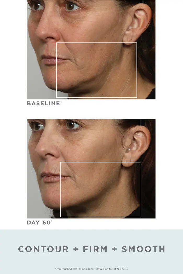 NuFACE® Trinity Facial Toning Device | Nordstrom | Nordstrom