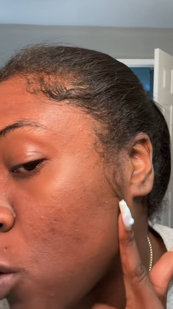 My face was so hairy before this! 

#LTKBeauty #LTKTravel #LTKWedding