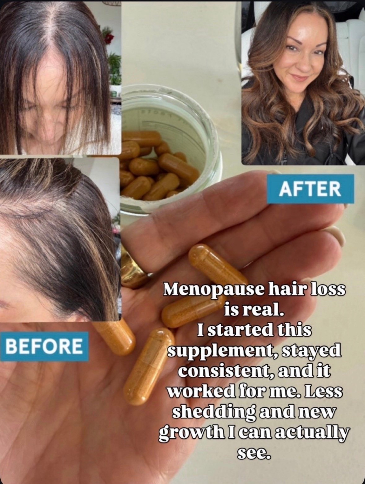 Menopause hair loss can be frustrating, but this is one supplement I stuck with and actually noticed a difference. After consistent use, I saw less shedding, new growth around my hairline, and overall healthier looking hair. If thinning hair has become a concern, this may be worth looking into.

hair growth supplement, menopause hair loss, thinning hair solutions, women over 50 wellness, hair regrowth journey, healthy hair habits, hair loss support, menopause symptoms, beauty from within, stronger hair, less shedding, wellness favorites, EverydayHolly

#LTKBeauty #LTKOver40 #LTKselfcare