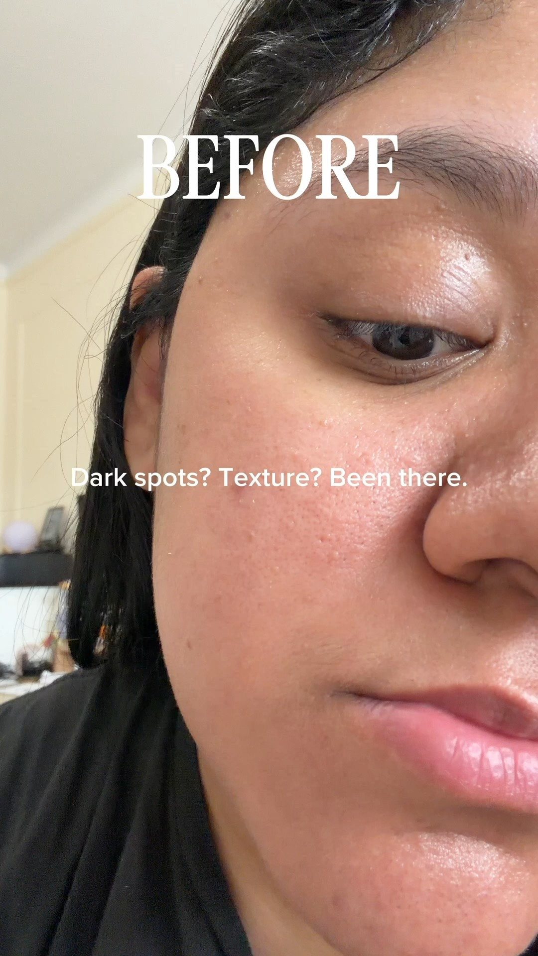 do you want an easy 2-step glass skin routine? try tia’m, a korean skincare brand made with vitamin-rich ingredients with science-backed actives! the change these products have made to my skin in 2 weeks honestly keeps me speechless. cannot recommend it enough.



amazon prime day, amazon prime deal, amazon prime sale, amazon skincare finds.

#LTKSaleAlert #LTKBeauty