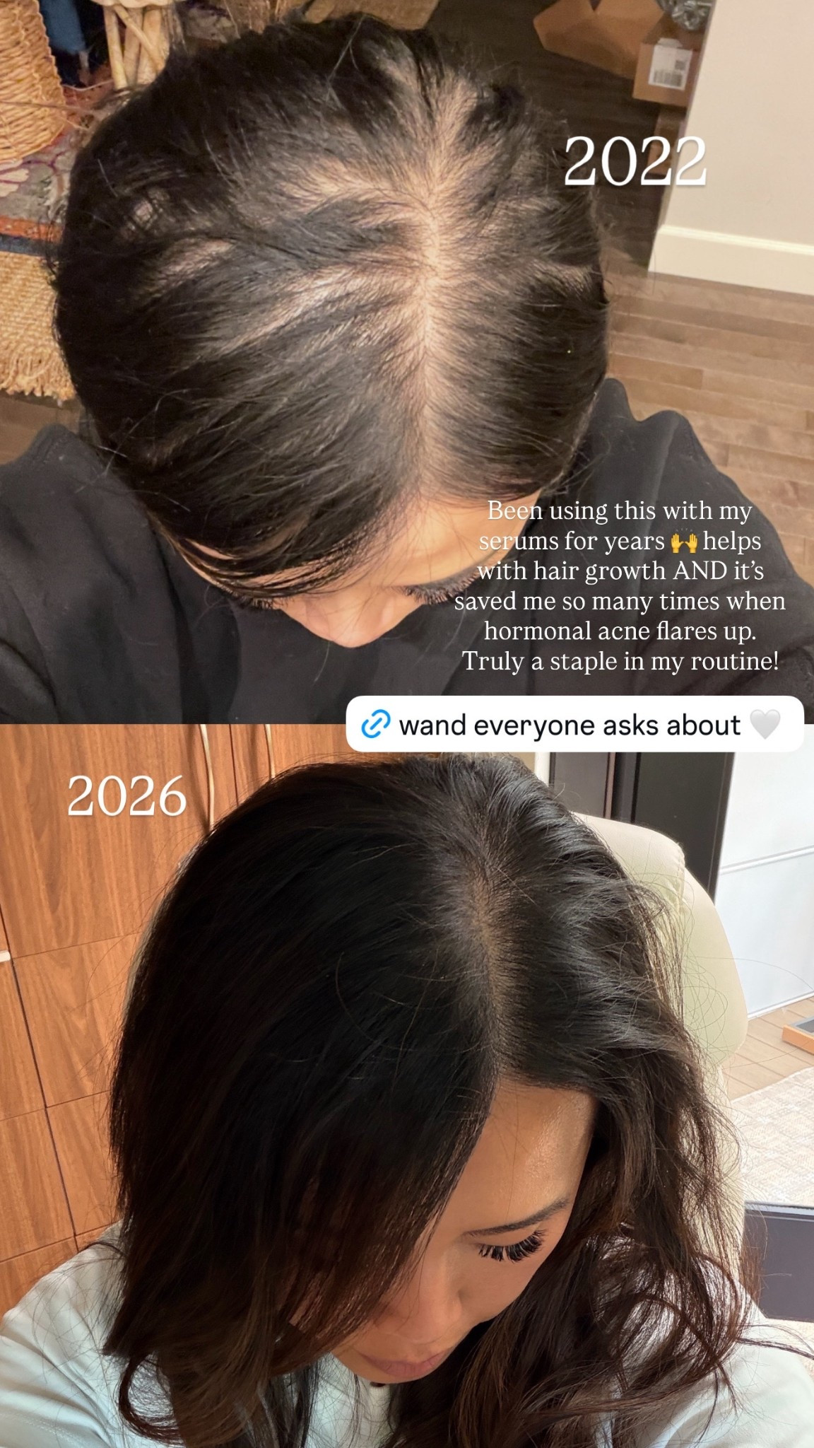 Things I used to help with Hair growth plus balance my hormones 