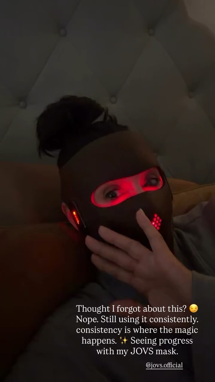 Thought I forgot about this? 😏 Nope. Still using it consistently… consistency is where the magic happens. ✨ Seeing progress with my JOVS mask. @jovs.official