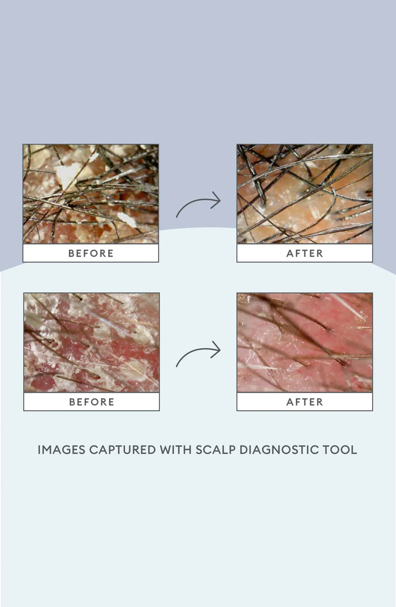 Scalp Saviors Set $60 Value | Nordstrom