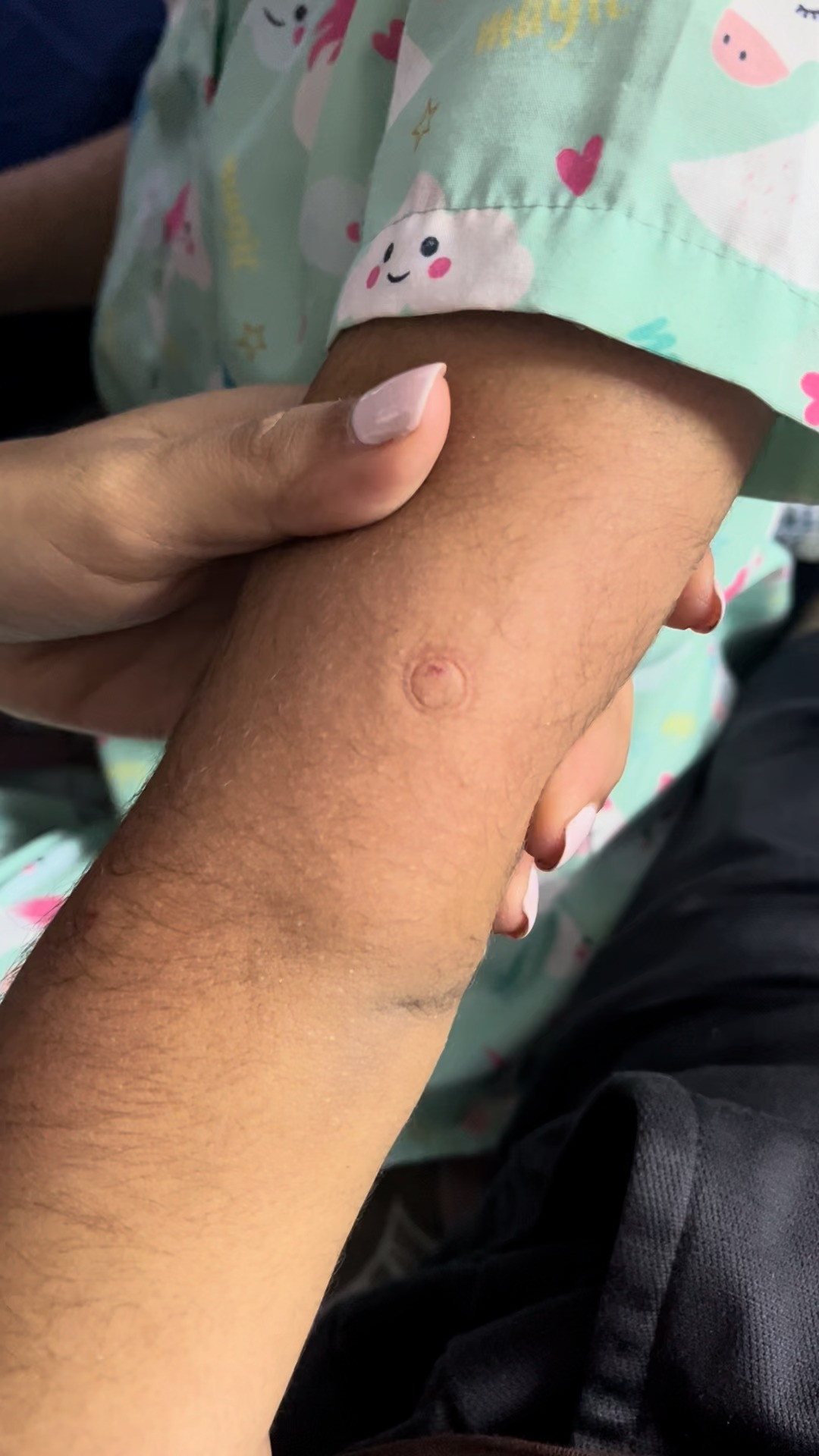 My go-to bug bite relief!! 

 #LTKselfcare #LTKHome #LTKKids