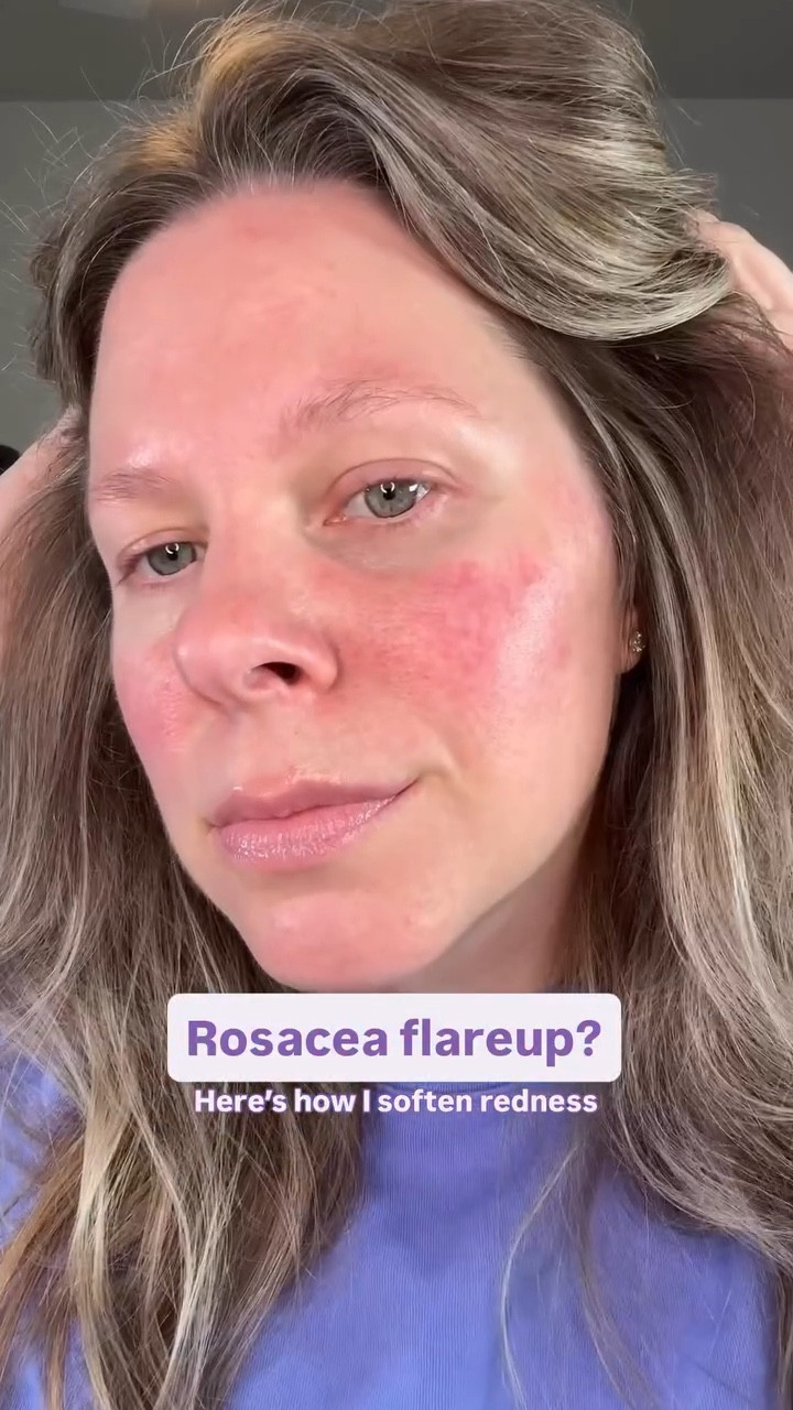 Halloween candy binge = rosacea flareup 😔. So what to do when this happens? Keep skincare simple and makeup light. Stay tuned for more everyday makeup tips for rosacea-prone skin 40+.

Products used: @qiqskincare hypochlorous spray, @merit moisturizer, @colorescience glowy spf, @erborian_usa cc red correct and @lauragellerbeauty powder. Happy to send these products your way. Just let me know in the comments!

#rosacea #rednessrelief #makeupformatureskin

#LTKOver40 #LTKmomlife #LTKBeauty