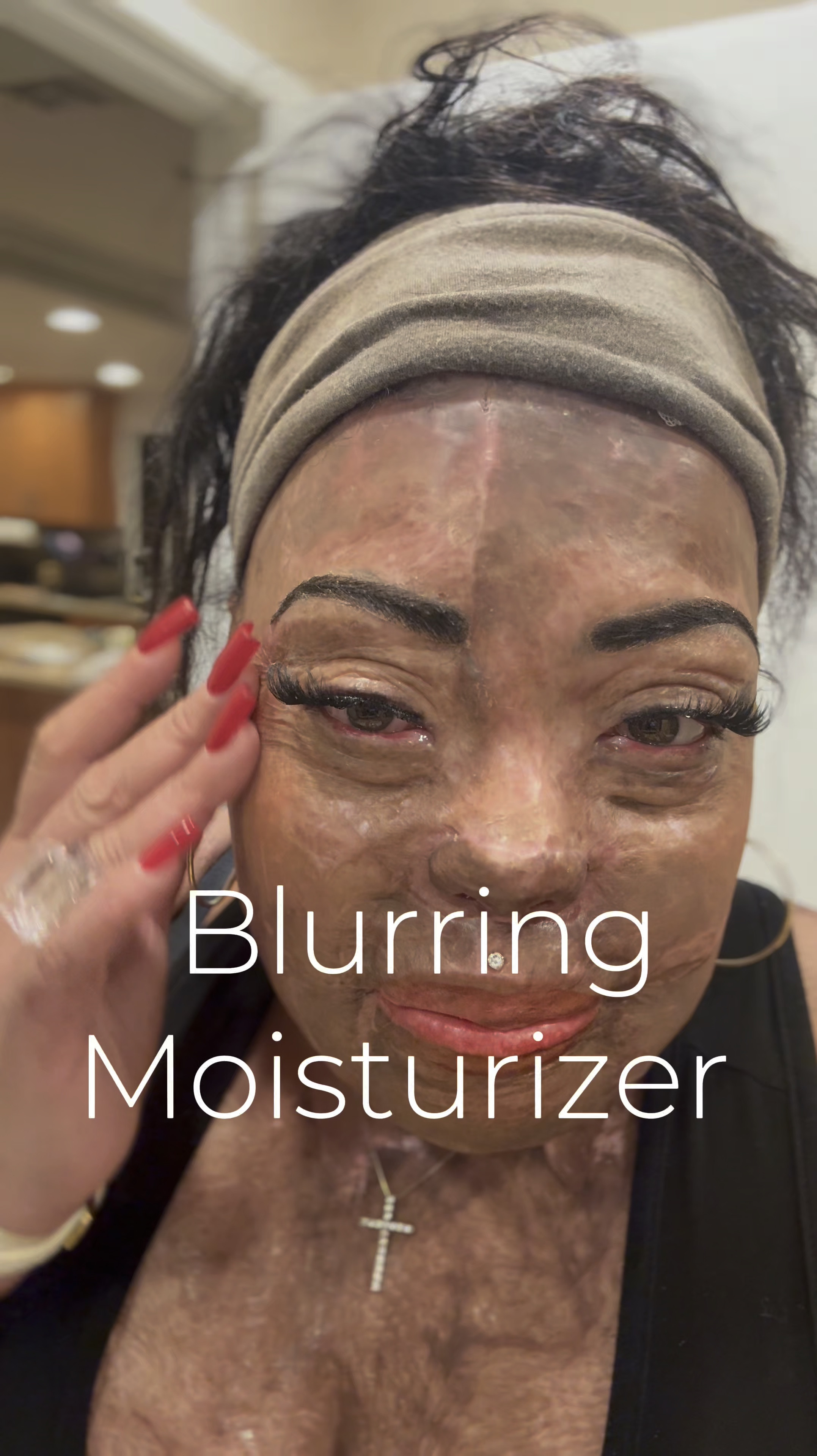 Good skin care has been key to healing during my nose reconstruction. 

Nanofat injections have been an absolute blessing as well. I’ve had them done twice and it takes 6 to 12 months to see full results, but they will soften my skin and even the tone. I can definitely already see a difference!🦋



blurring moisturizer, skin hero glow, glass skin, growth factor serum, copper tripeptide 

#LTKBeauty #LTKWatchNow #LTKOver40