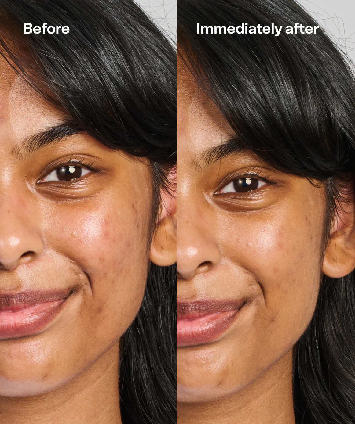 Under Cover | Bubble Skincare