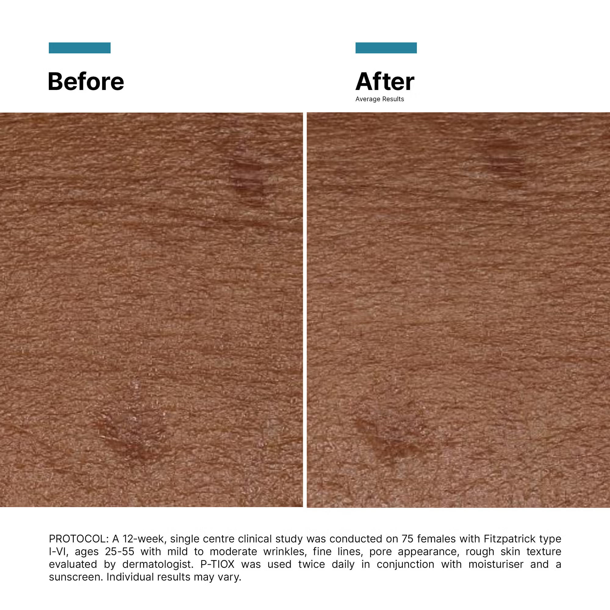 SkinCeuticals P-Tiox Neuro-Peptide Serum 30ml | Look Fantastic (UK)