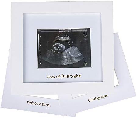Baby Sonogram Photo Frame - 1st Ultrasound Picture Frame - Idea Gift for Expecting Parents,Baby S... | Amazon (US)