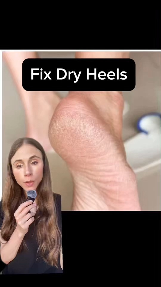 Fix Dry Feet FAST #skincare  

 #LTKBeauty