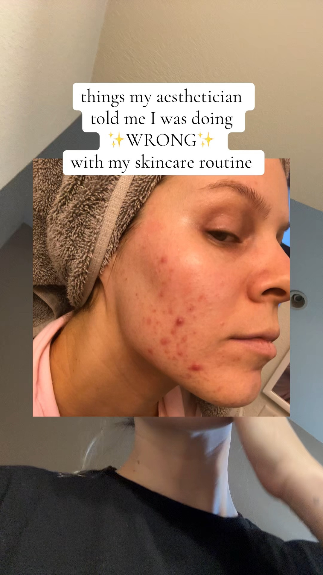 I cannot say enough good things about this Korean Skincare set!💕

#skincare #skincareroutine
#koreanskincare #koreanskincareproducts #koreanskincare101 #pdrn #acne #acneskin #acneskincare #anuaskincare 

#LTKFindsUnder50 #LTKBeauty #LTKGiftGuide