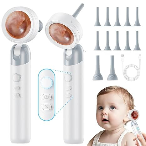 Otoscope Ear Camera with Light, 1.4” Screen 1080P HD Ear Scope, 12 Silicone Specula Tips, Photo... | Amazon (US)