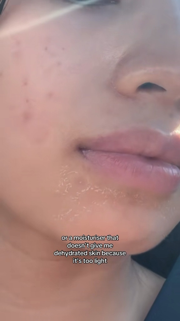 if you have oily acne prone skin, I’d recommend this moisturizer to keep your skin hydrated and to support skin barrier! This did not cause me to breakout or clog my pores. So highly recommend! 

#LTKselfcare #LTKValentine #LTKvlog