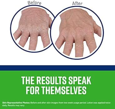 Amazon.com: O'Keeffe's Working Hands Hand Cream 3oz Tube and O'Keeffe's Eczema Relief Hand Cream,... | Amazon (US)